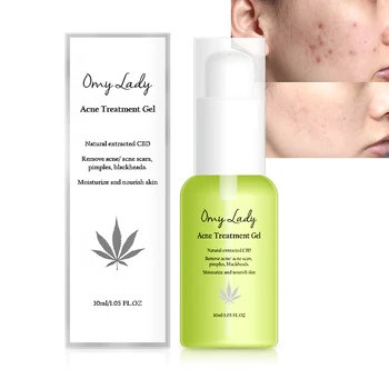 

Acne Treatment Face Cream Blackhead Repair Gel Oil Control Shrink Pores Scar Fade Marks Scars Moisturizer Skin Care 30ml