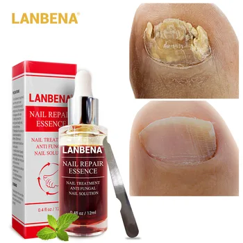 

LANBENA Nail Repair Essence Serum Fungal Nail Treatment with File Remove Onychomycosis Toe Nourishing Brighten Hand Foot Care