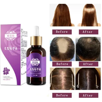 

Hot 20ML Hair Loss Products Natural With No Side Effects Grow Hair Faster Regrowth Hair Growth Products