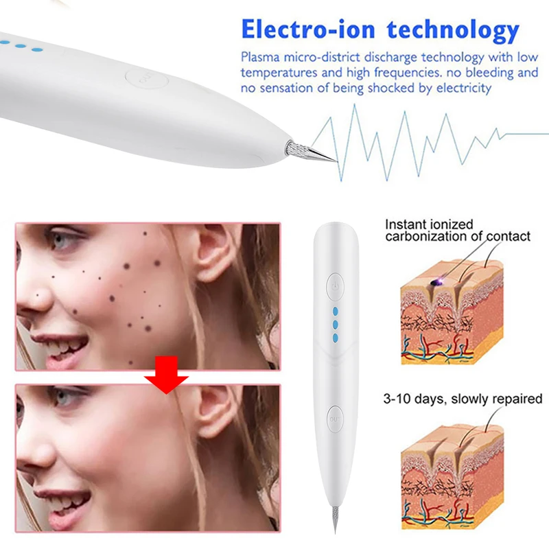 Портативный бытовой точечный карандаш для удаления пятен прыщей карандаш для удаления веснушек лица акне инструмент для красоты плазменное устройство для красоты Ручка