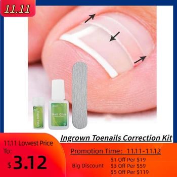 

12pcs Ingrown Toenail Patch Correction Tool Ingrown Foot Rest Pedicure Clip Brace with Glue Nail Supplies for Professionals
