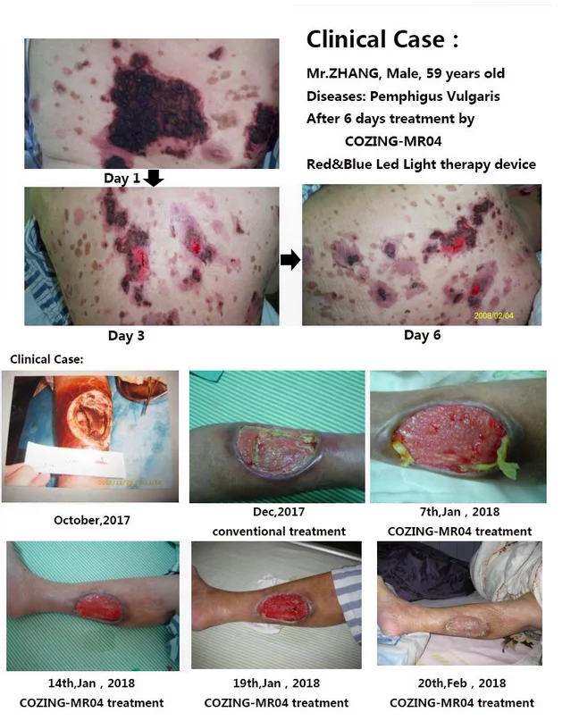 ~SN2JEE[G(%C%S[{DX5W12N