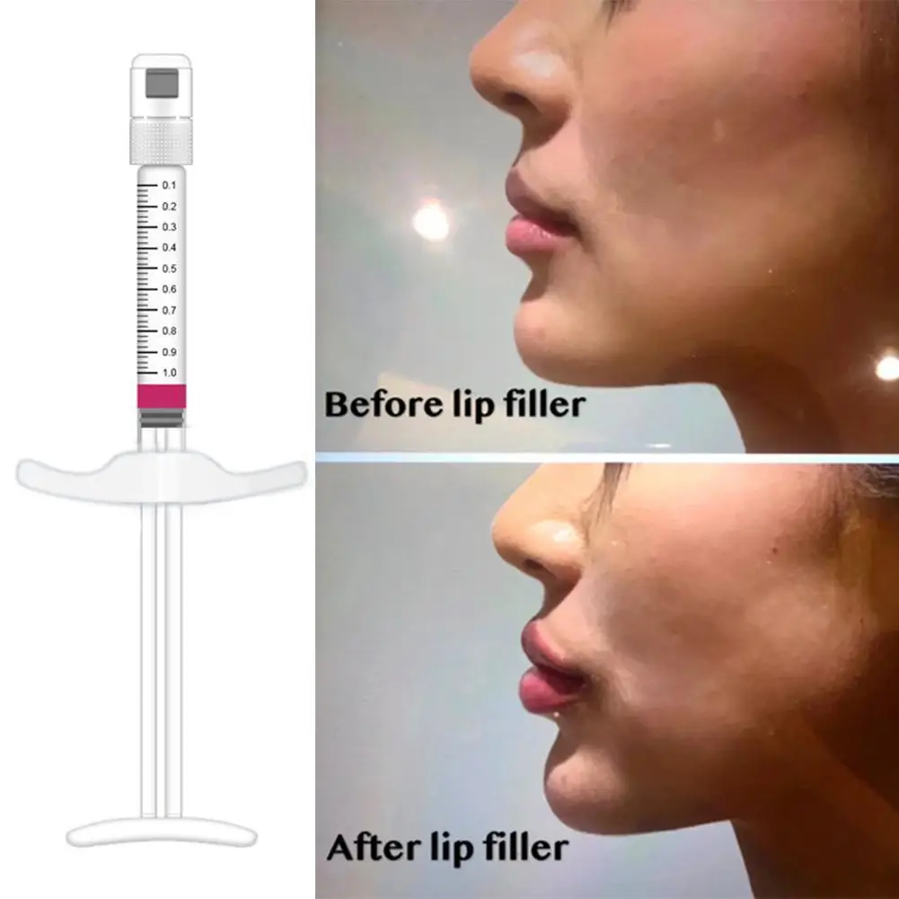 Small Molecule Hyaluronic Acid Filler Lip/Nose/Cheek Hyaluronic Acid Crosslinked HA Lips