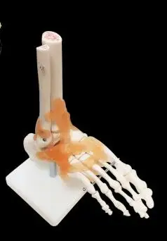 Съемная модель коленного сустава handt/foot/shoulder/hip joint обучающая модель - Цвет: Золотой