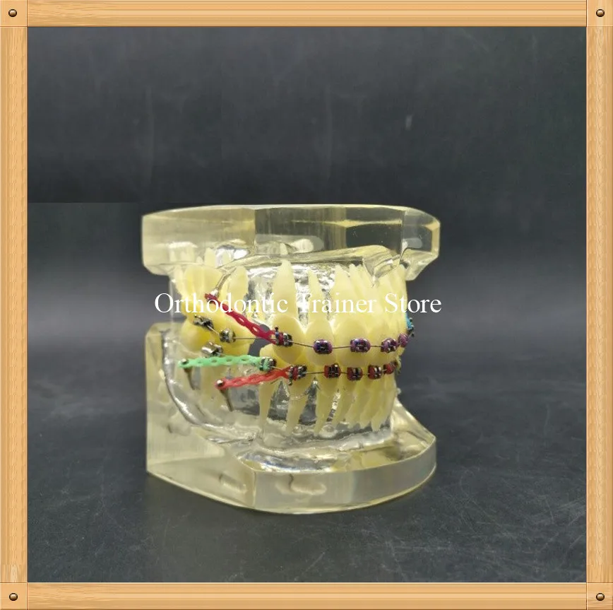 

Orthodontic Fault Correction display Teeth Model/Dental Orthodontic tooth Model/Dental Othodontic Study Teeth Model
