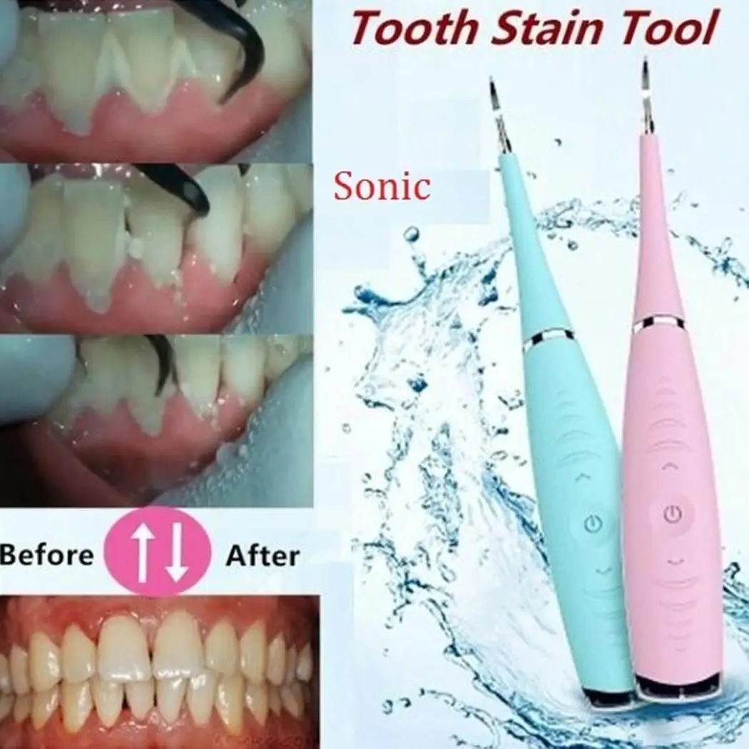 

Portable Electric Dental Stone Remover Tooth Stain 5 files Tartar about 2H USB 300mAh Cleaning Tool 0.173kg