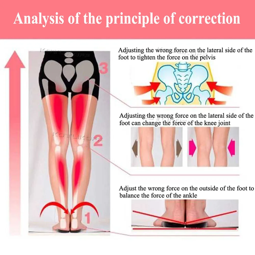 Unisex O/X Leg Valgus Varus Corrector Orthotic Insoles Foot Pads Heel Correction Pads Inside Outside Feet Insert Insoles shoe insoles