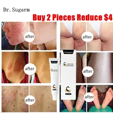 Comprar 2 reduzir us4 eczema psoríase creme para atletas pé, jock coceira, miolo, eczema, picadas de mosquito, erupção cutânea, pé e creme para o corpo