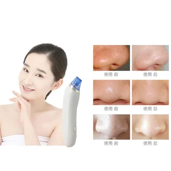 

Instrument Mite-removal Shrink Pores Removing Acne Pore Cleaner Facial Part Instrument