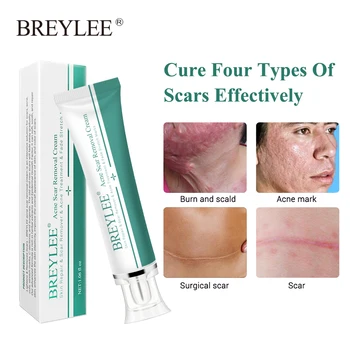 

BREYLEE Acne Scar Removal Cream Skin Repair Face Cream Skin Care Scar Acne Treatment Remove Stretch Marks Whitening Cream 30g