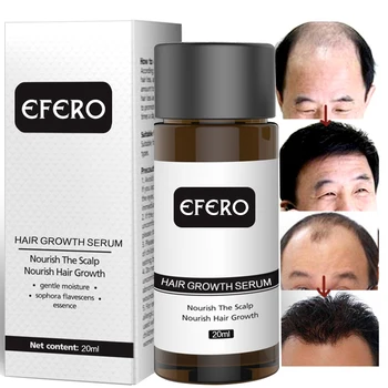 

Fast Powerful Ginger Hair Growth Essence Oil Hair Loss Products for Hair Growth Serum Beard Growth Essential Health Care