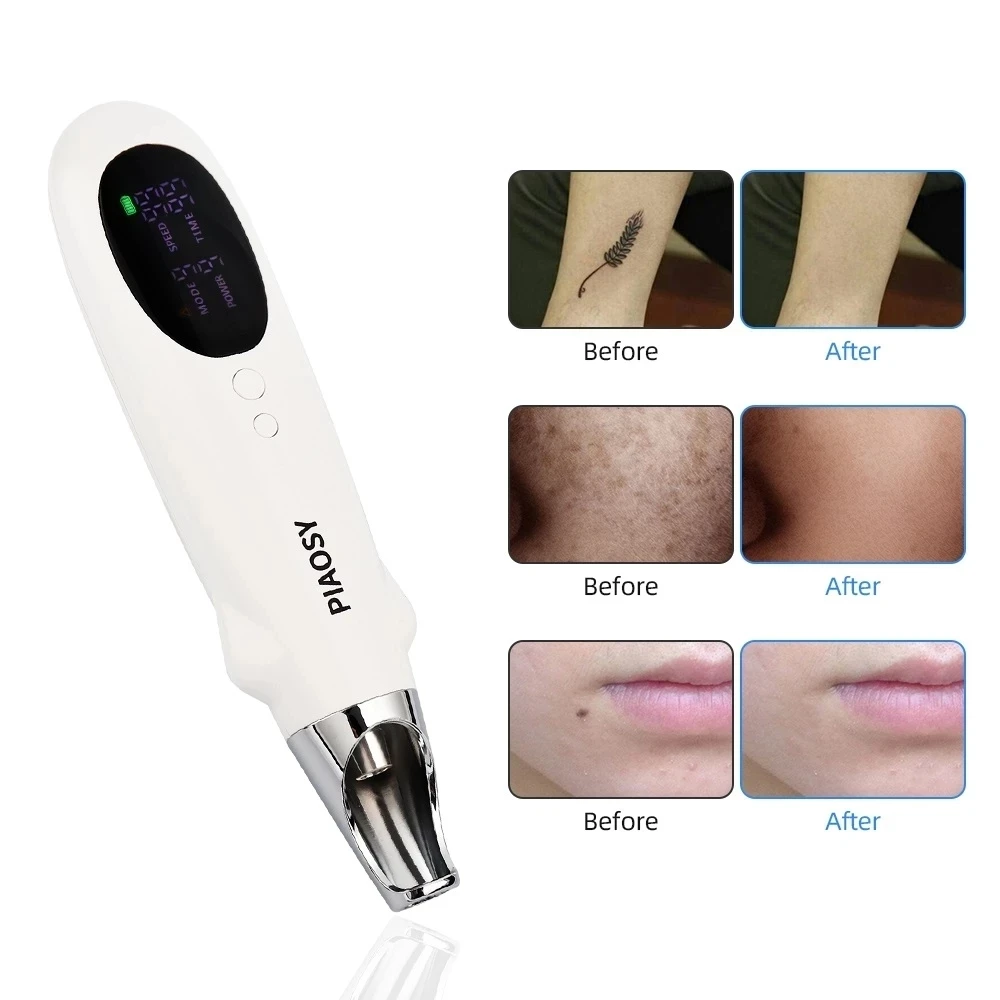 Newest Neatcell Handheld Picosecond Laser Tattoo Removal Profesional  Machine 9+9 Upgrade Mole Tattoo Wart Remover Pen Fade Line|Home Use Beauty  Devices| - AliExpress