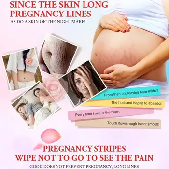 

50ml Treatment Oil For Stretch Mark Removal Maternity Oils Skin For Pregnant Oil Remover Slackline Stretch Essential Marks S1R2