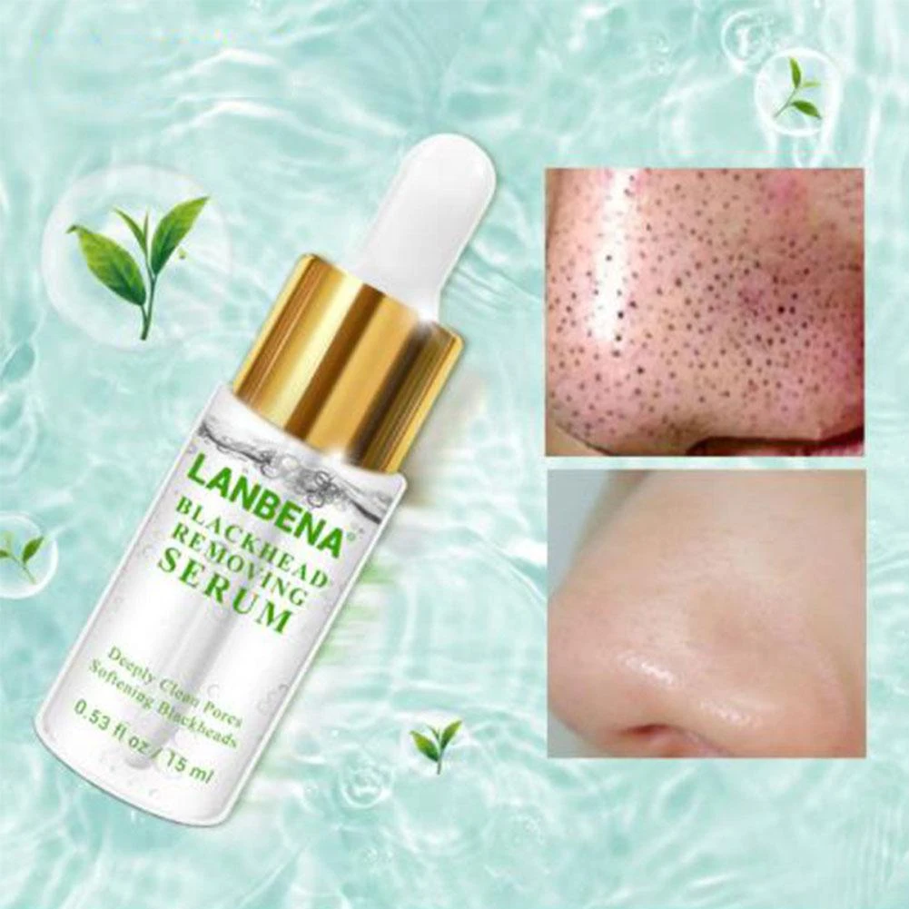 blackhead deep cleansing solution