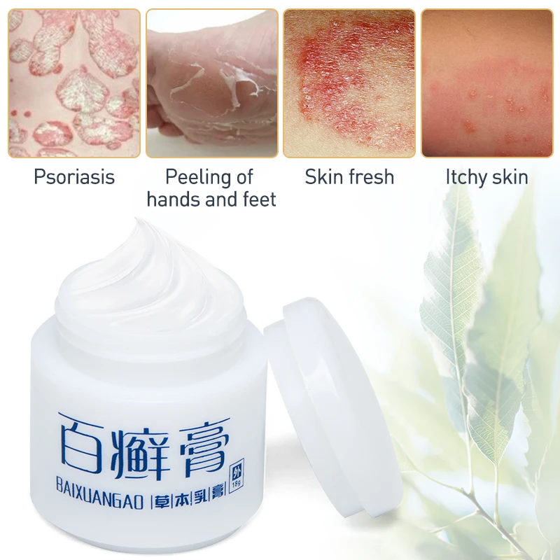 1PC Skin Care ItchPain Relief Ointment Herbal Psoriasis Creams For Hand