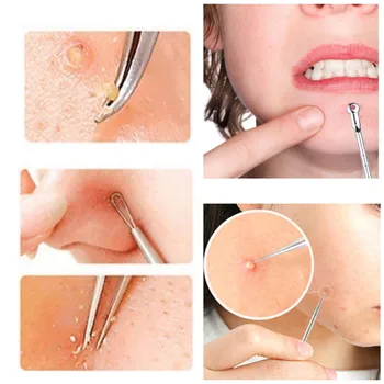 

4 Pcs Stainless Facial Acne Spot Pimple Remover Cosmetic Dust Removal Acne Needle Extractor Tool