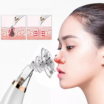 

Face Deep Pore Cleaner Acne Vacuum Cleaner Black Dot Blackhead Remover Pimple Blackhead Removal Vacuum Cleaner Women 1pc