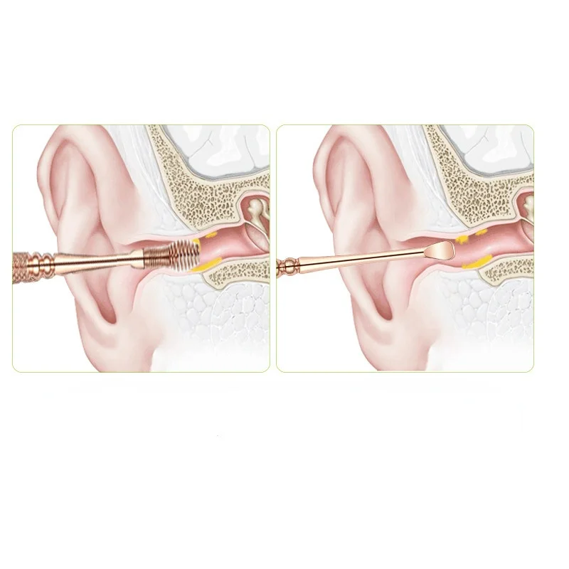 Description Picture 2 of itemSpiral Massage Ear Pick 360 Spiral Ear Wax Remover Ear Canal Cleaner Stainless Steel Flexible Design Ear Care Tools