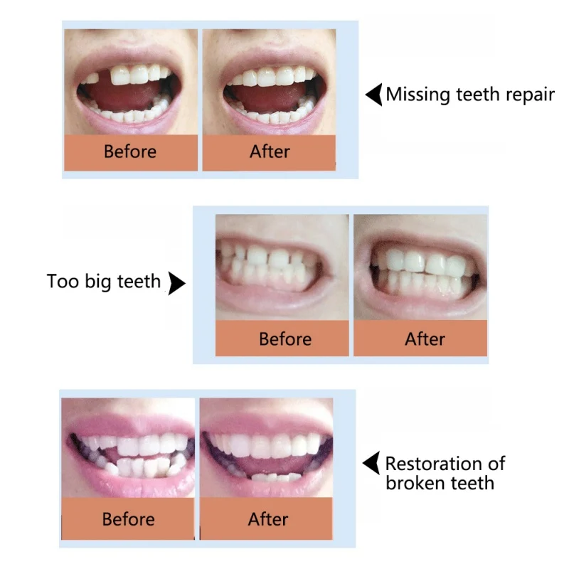 FalseTeeth твердый клей Временный набор для ремонта зубов зубные протезы зубы