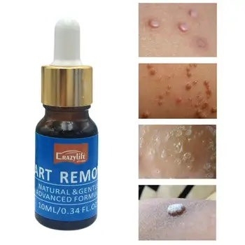 

Feet Corn Remover Powerful Foot Fingers Callus Remover Smooth Safe Skin Care Rejuvenation Warts Skin Body Treatment Liquid P0L2