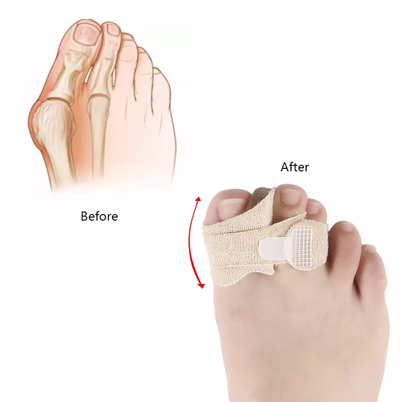 

New Toe Separator Valgus Corrector Orthotics Feet Thumb Adjuster Correction Belt Pedicure Straightener Foot Care