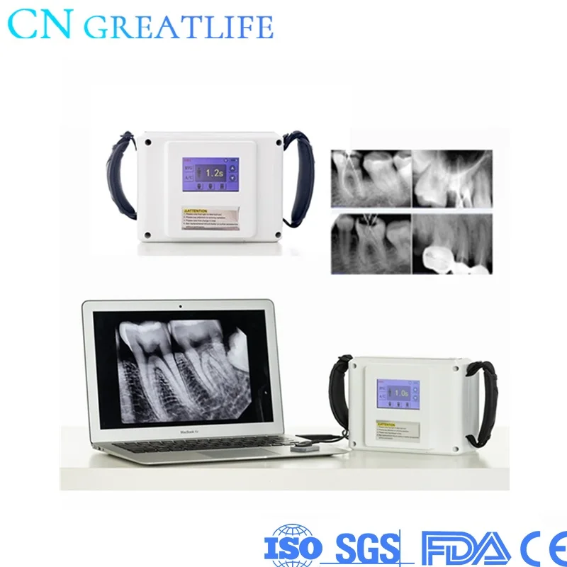 Good Price LCD Touch Screen Wireless Imaging System Digital Machine Unit Portable Dental X Ray | Красота и здоровье
