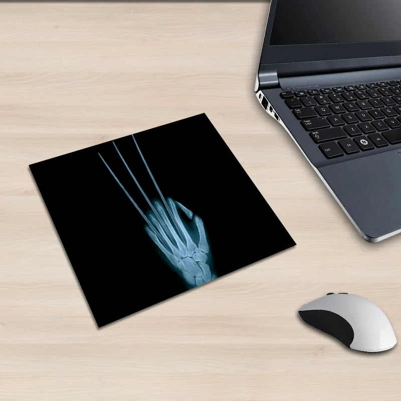 XGZ ноутбук X-ray Man Imaging Picture квадратный коврик для мыши для верховой езды гиена хип-хоп PC коврик колесо скейтборд резиновый противоскользящий Универсальный
