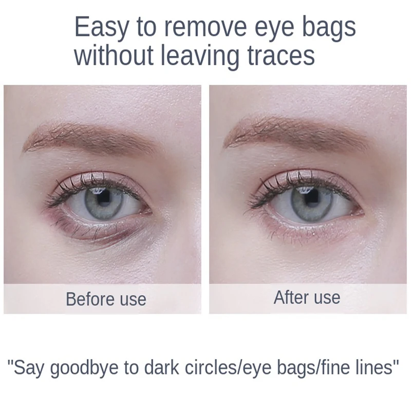 high frequency dark circles