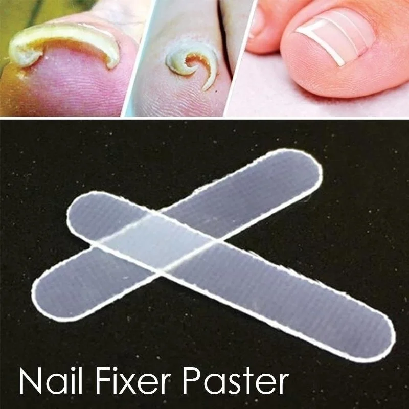 

1Pcs Nail Fixer Paster Ingrow Physical Bending Toe Correction Tool