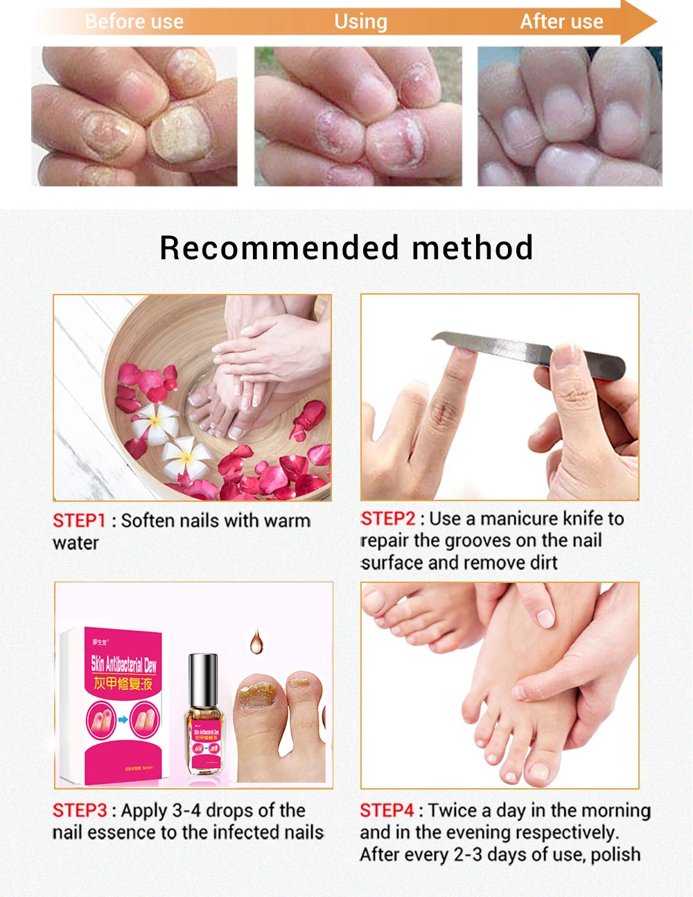 лечение ногтей волжский фуст. лечение ногтей волжский фуст. лечение ногтей волжский фуст. лечение ногтей волжский фуст. крем от грибка ногтей.