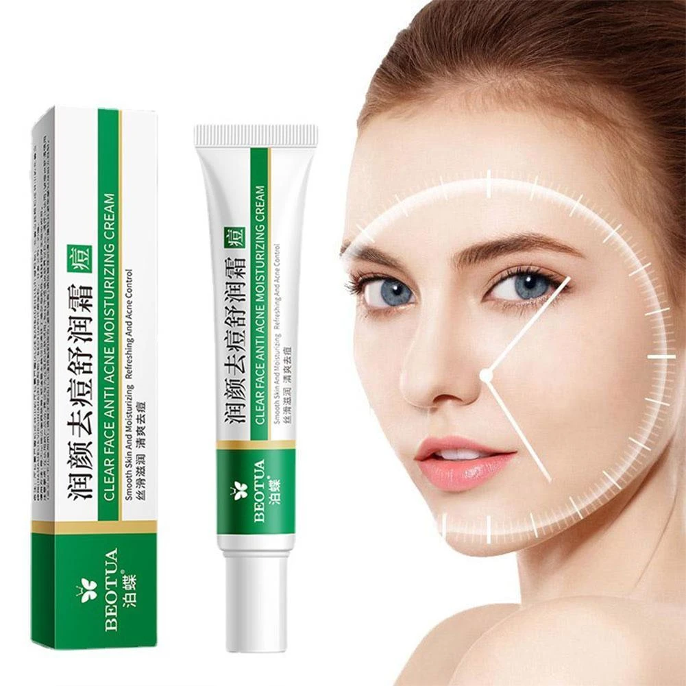 20g Effective Acne Removal Cream Herbal Acne Spots Oil Control Acne