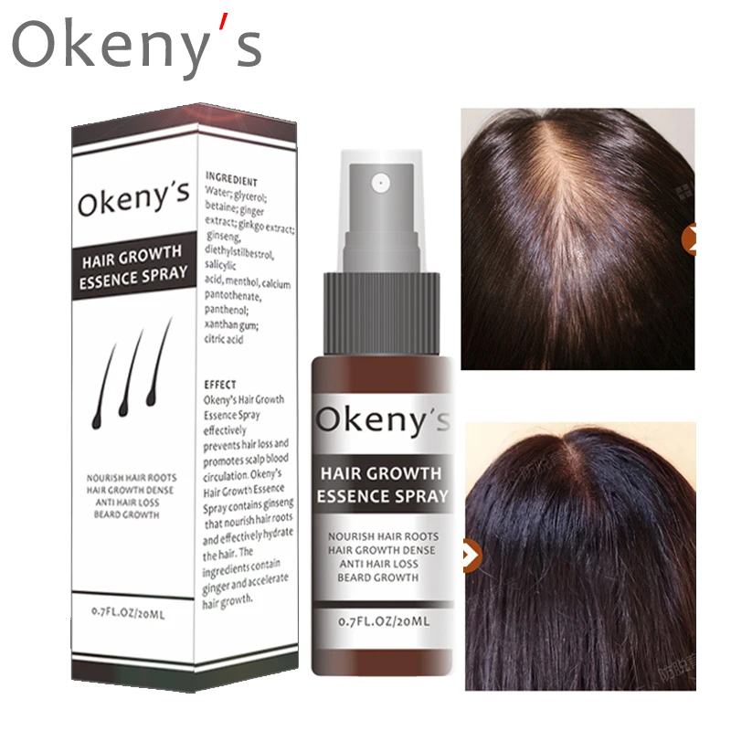 

Okeny's Hair Growth Essence Spray Growth Oil Preventing Baldness Anti Hair Loss Hair Care Nourishing Enhancing Hair Roots