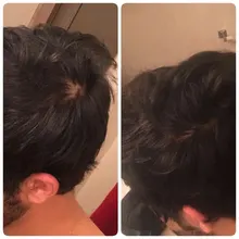 El crecimiento del cabello aceites esenciales cuidado del cabello esencia Original auténtico 100% pérdida de cabello líquido salud belleza suero denso para el crecimiento del cabello