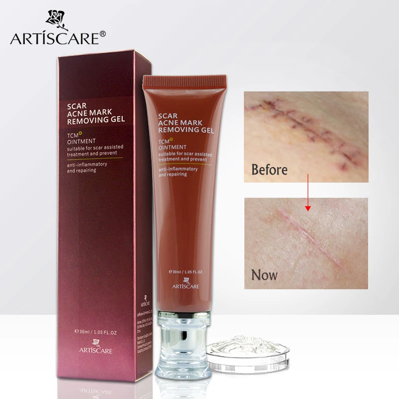 face marks removing cream