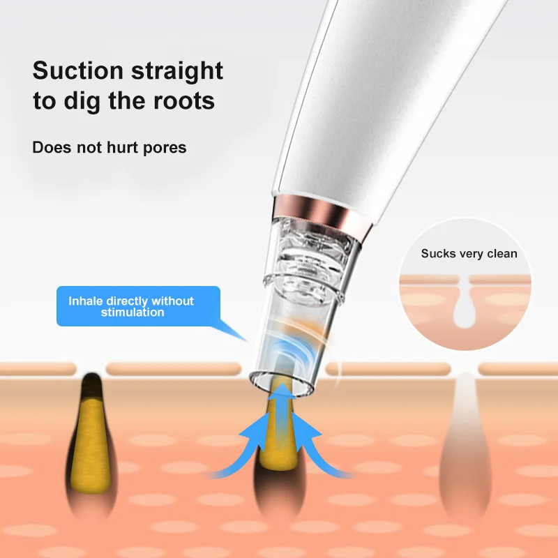 Вакуумный прибор для чистки кожи лица с USB портом|Устройство ухода за кожей лица| |