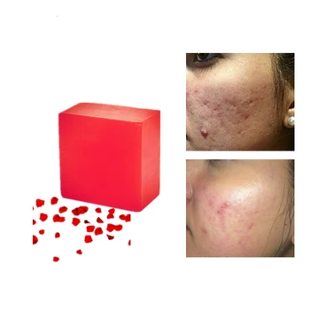 

1 Pcs Anti Allergy Desalination Skin Pigments Rose Extraction Soaps Moisturizing Anti Wrinkle Whitening Beauty Handmade Soaps