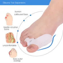 

Silicone Gel Bunion Big Toe Separator Spreader Eases Foot Pain Foot Hallux Valgus Correction Guard Cushion Foot Care Tool