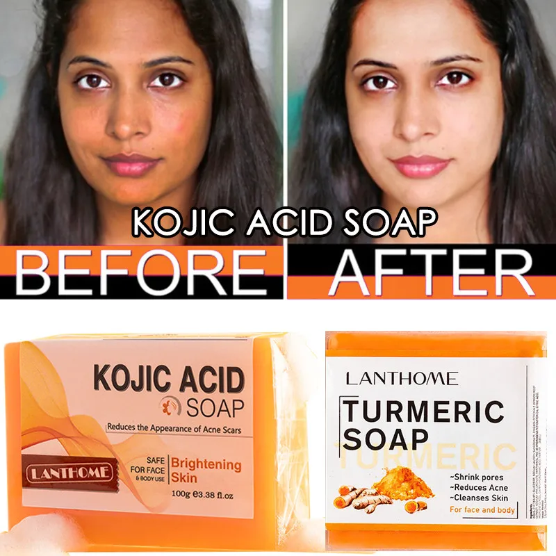 Kojic Soap Side Effects