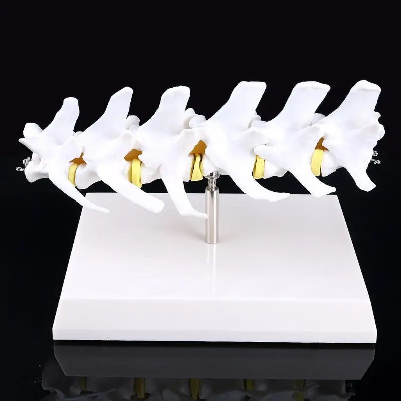 

Dog Canine Lumbar Disc Herniation Model Aid Teaching Anatomy Instruments Study Research Display