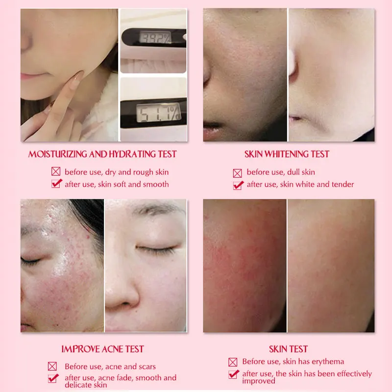 Купить 3 получить 1 подарок ARTISCARE улиточная Сыворотка против морщин старения уход