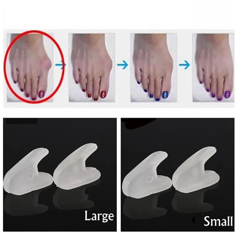1 Pair A-Shaped Splitter SEBS Toe Thumb Valgus Corrector Toe Overlap Separator Small Toe Correction Stretcher Straightener