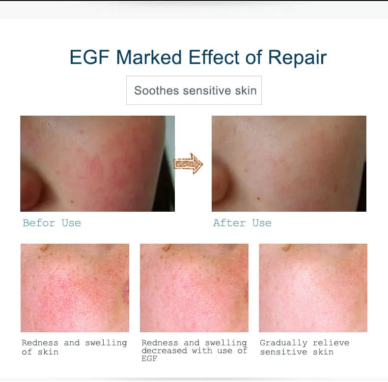 egf_07