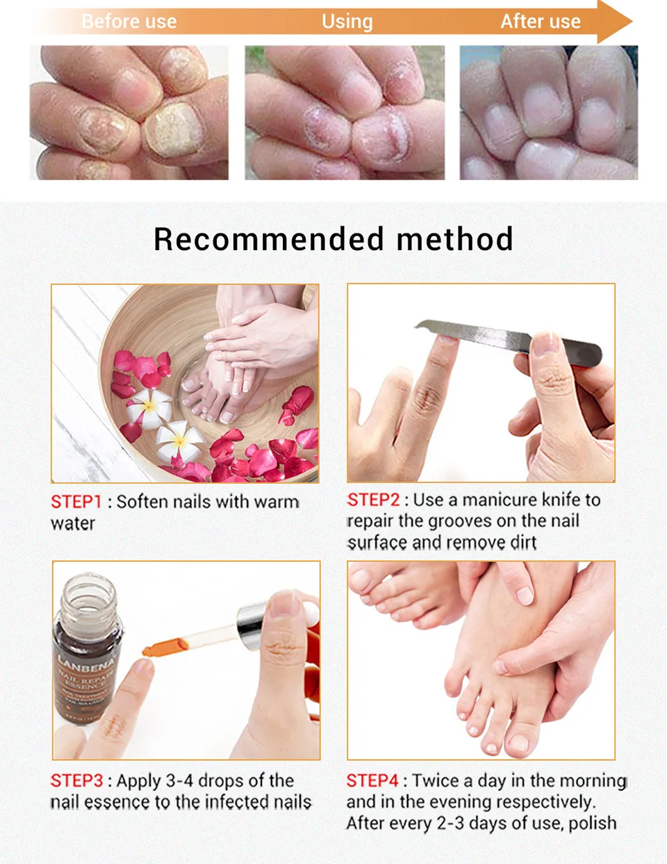 LANBENA эссенция для восстановления ногтей и гель эффективное лечение проблем с ногтями и ногтями на ногах