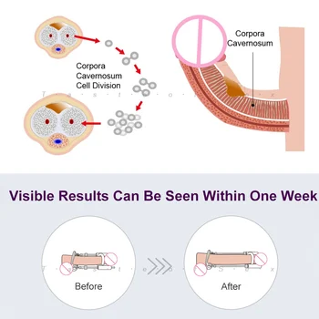 Max Penis Extender Penis Enlargement Device Penis Enlarger Stretcher System Cock Growth Train Penis Pump Adult Sex Toys For Male 3