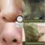 50 г Маска Из Зеленого Чая Нос Для Удаления Угрей Маска Shrink Pore Peeling Acne Treatment Deep Cleansing Mask Powder