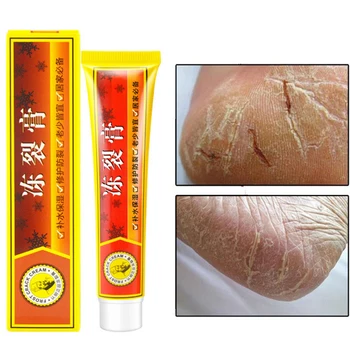

Anti Dry Crack Skin Ointment Cream Health Hand Foot Crack Cream Heel Chapped Peeling Foot Hand Repair Skin Care