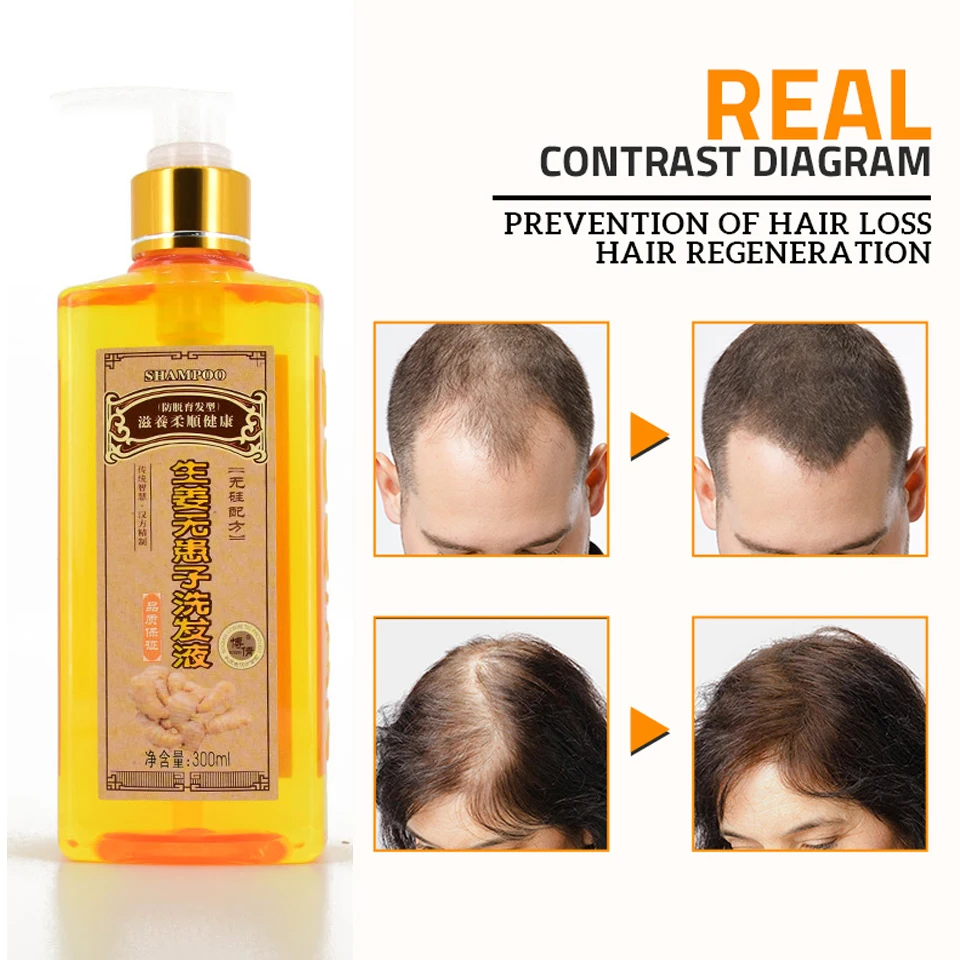 

Genuine Professional Hair ginger Shampoo 300ml, Hair regrowth Dense Fast, Thicker, Shampoo Anti Hair Loss Product
