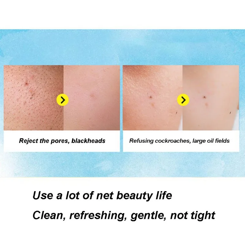Новое поступление увлажняющее масло-контроль анти-клещи анти-acnes мыло для сыра матовый Мыло для лица Очищение лица Косметическое Мыло