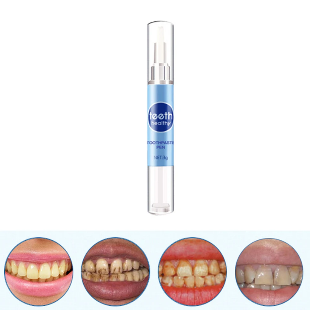 1 шт., стоматологическая ручка для отбеливания зубов, идеальная улыбка, белый зуб, Оральный гель для отбеливания, абсолютный белый деликатный пятновыводитель