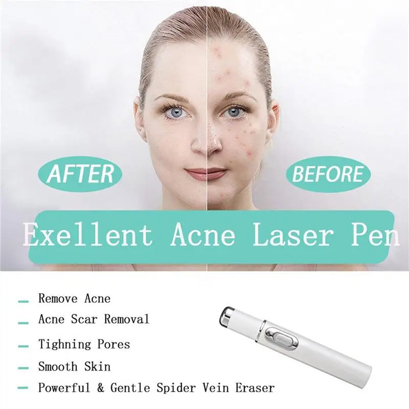 Blue Light Therapy Varicose Veins Treatment Laser Pen Soft Scar Wrinkle Removal Treatment Acne Laser Pen Massage Relax blue light therapy pen laser pen therapy